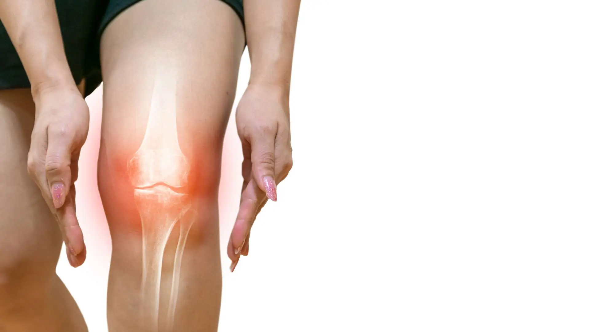 Genou droit de femme avec vue 3D des os et inflammation rouge